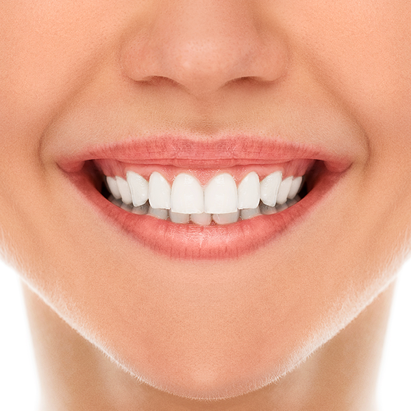 VITIS COLUTORIO ENCIAS 1000 ML